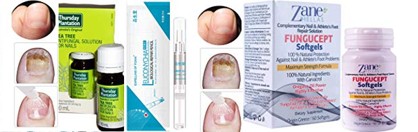 巻き爪と爪水虫