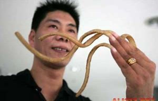 巻き爪はなぜおこる？