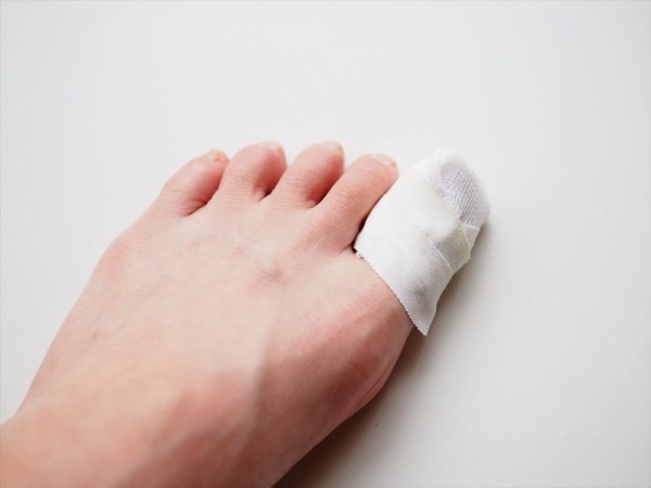 割れ爪の原因とは？予防法と対策を徹底解説！