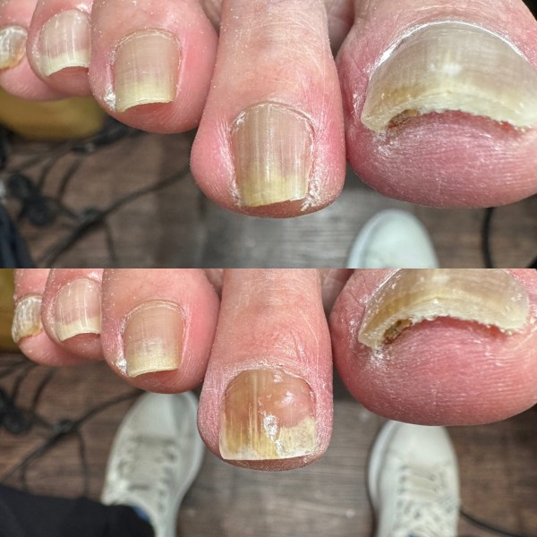 久しぶりの症例報告です。